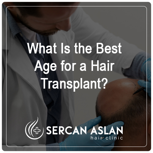 What Is the Best Age for a Hair Transplant?