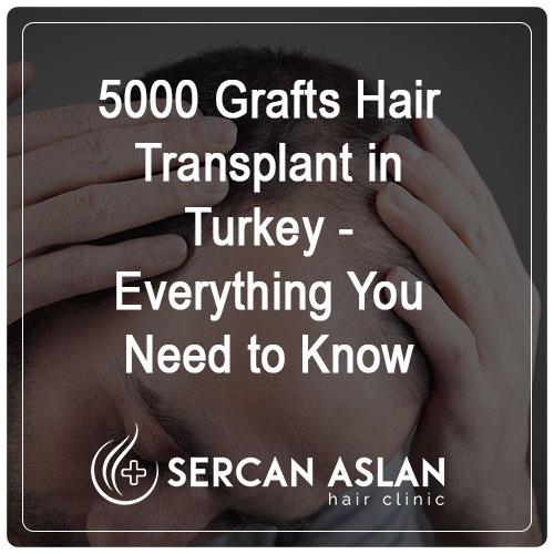 5000 Grafts Hair Transplant in Turkey – Everything You Need to Know