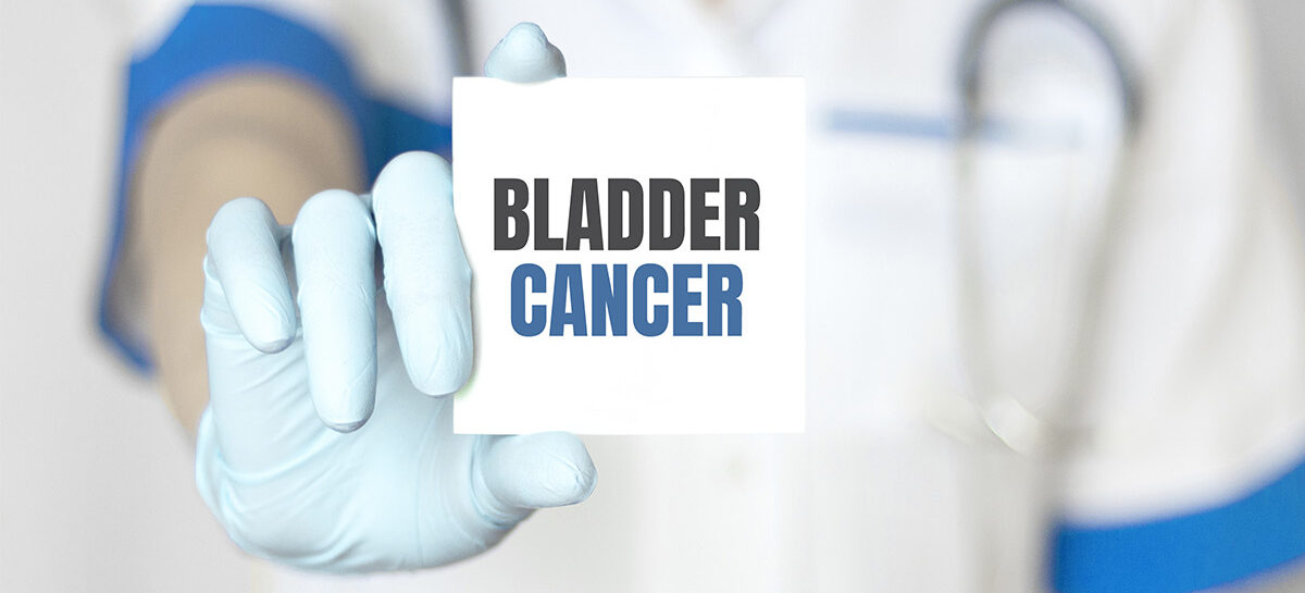 	 Bladder Cancer: Comprehensive Insights into Diagnosis, Staging, and Advanced Treatment| Kauvery Hospital Bangalore, Chennai, Trichy, Salem, Tirunelveli
