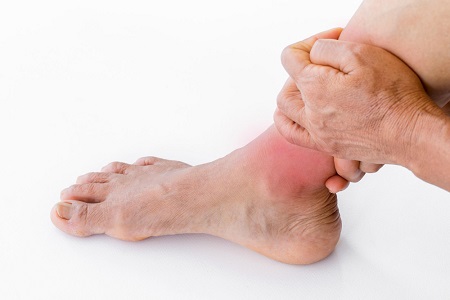 When Is Reconstructive Foot Surgery Recommended