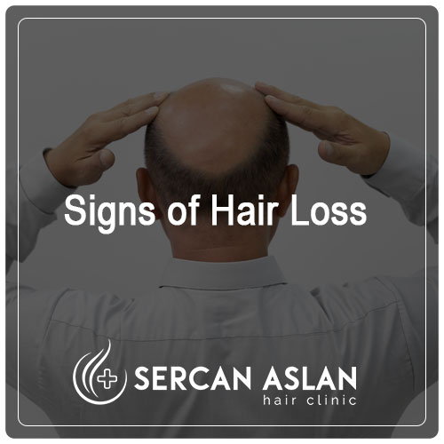 Signs of Hair Loss