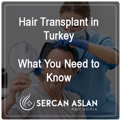 Hair Transplant in Turkey – What You Need to Know