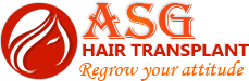 ASG Hair Transplant Centre ASG Hair Transplant Centre