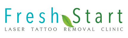 Fresh Start Laser Tattoo Removal Clinic Fresh Start Laser Tattoo Removal Clinic