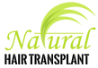 Hair Transplant in Allahabad Hair Transplant in Allahabad