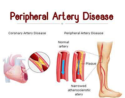 Vascular Surgeon In Hyderabad