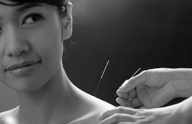 Bondi Acupuncture Bondi Acupuncture