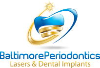 Baltimore Periodontics Lasers & Dental Implants