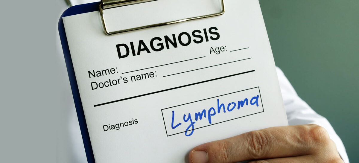 Lymphoma - Types, Genetic Risks