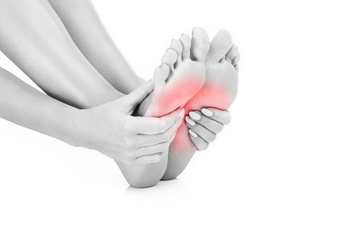 Plantar Fasciitis