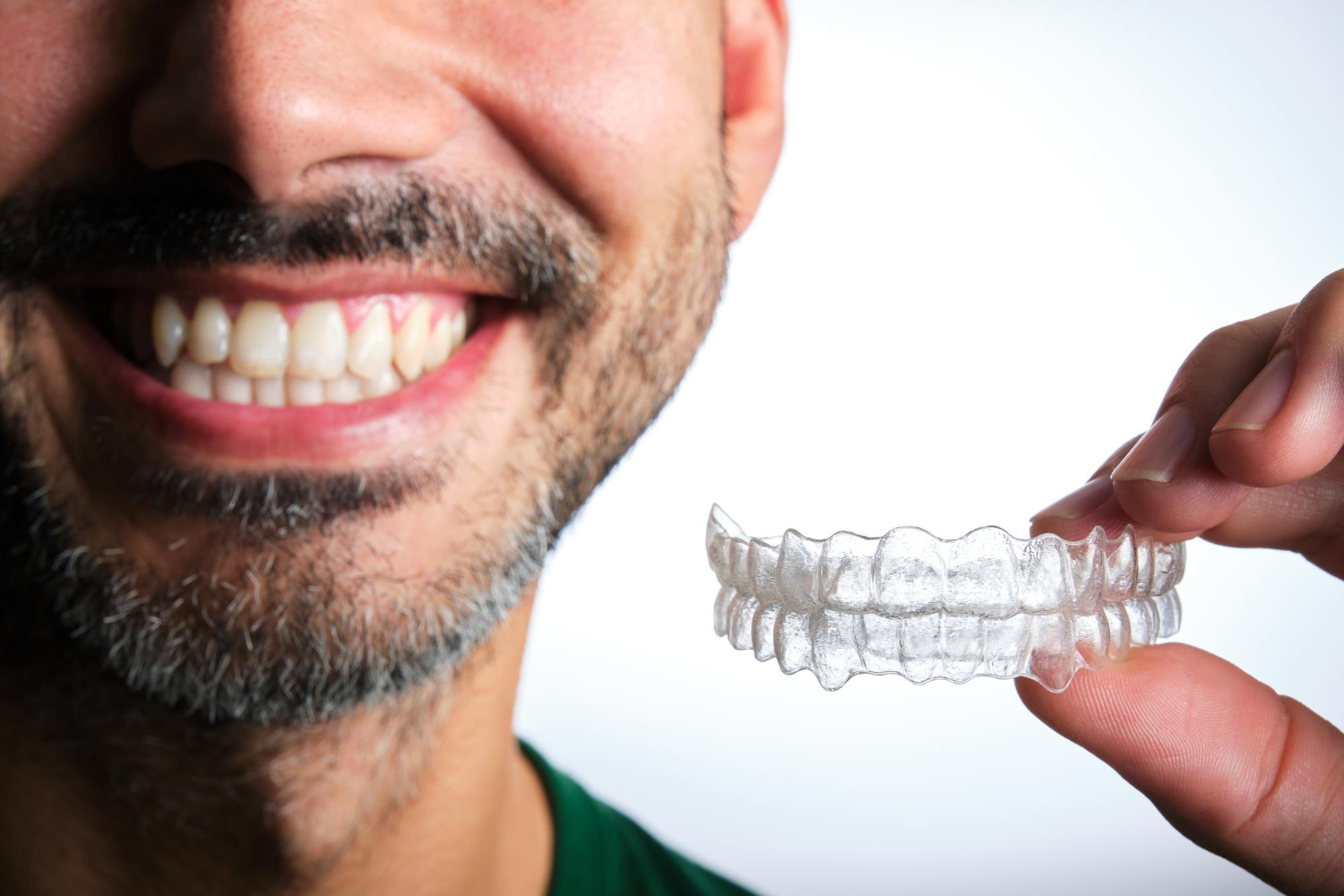 DIY Teeth Aligners