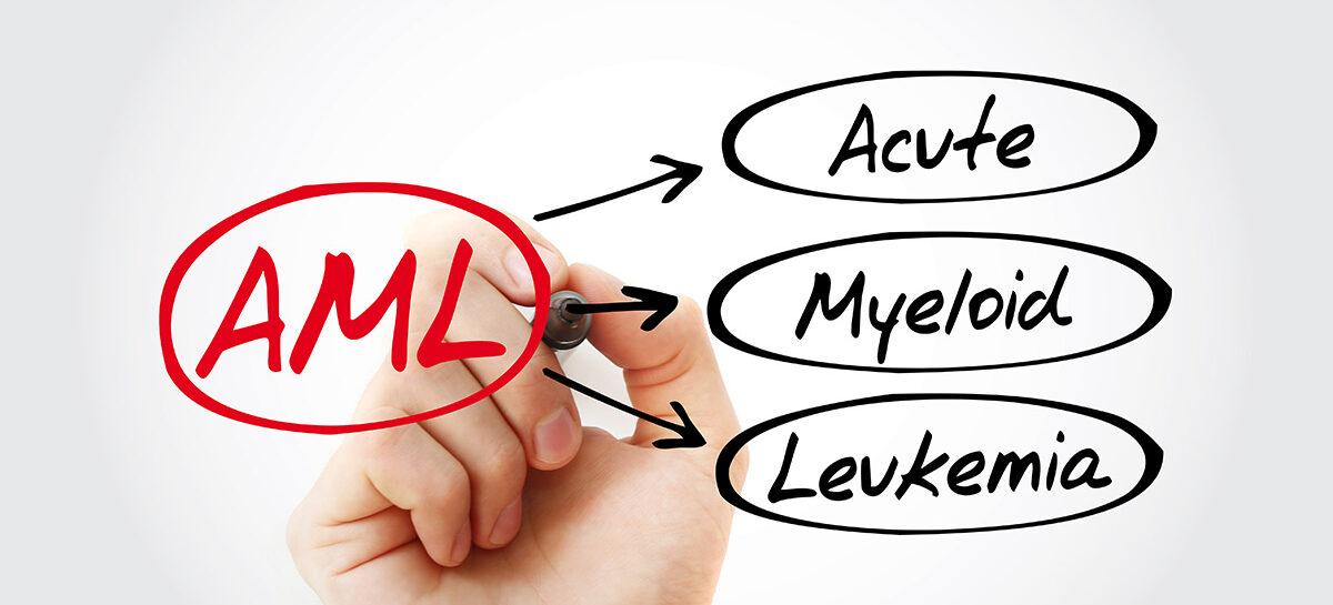 Treatment of Acute Myeloid Leukaemia