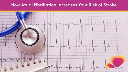 Atrial Fibrillation