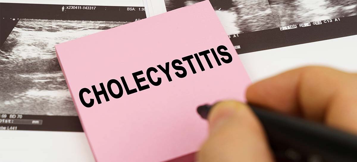 Understanding Cholecystitis Inflammation of the Gall Bladder