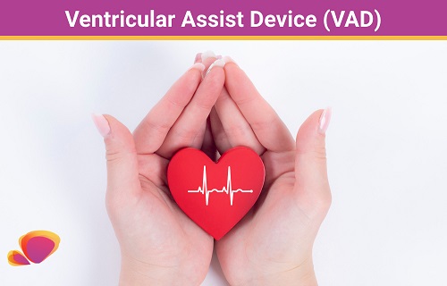 Ventricular Assist Device (VAD)